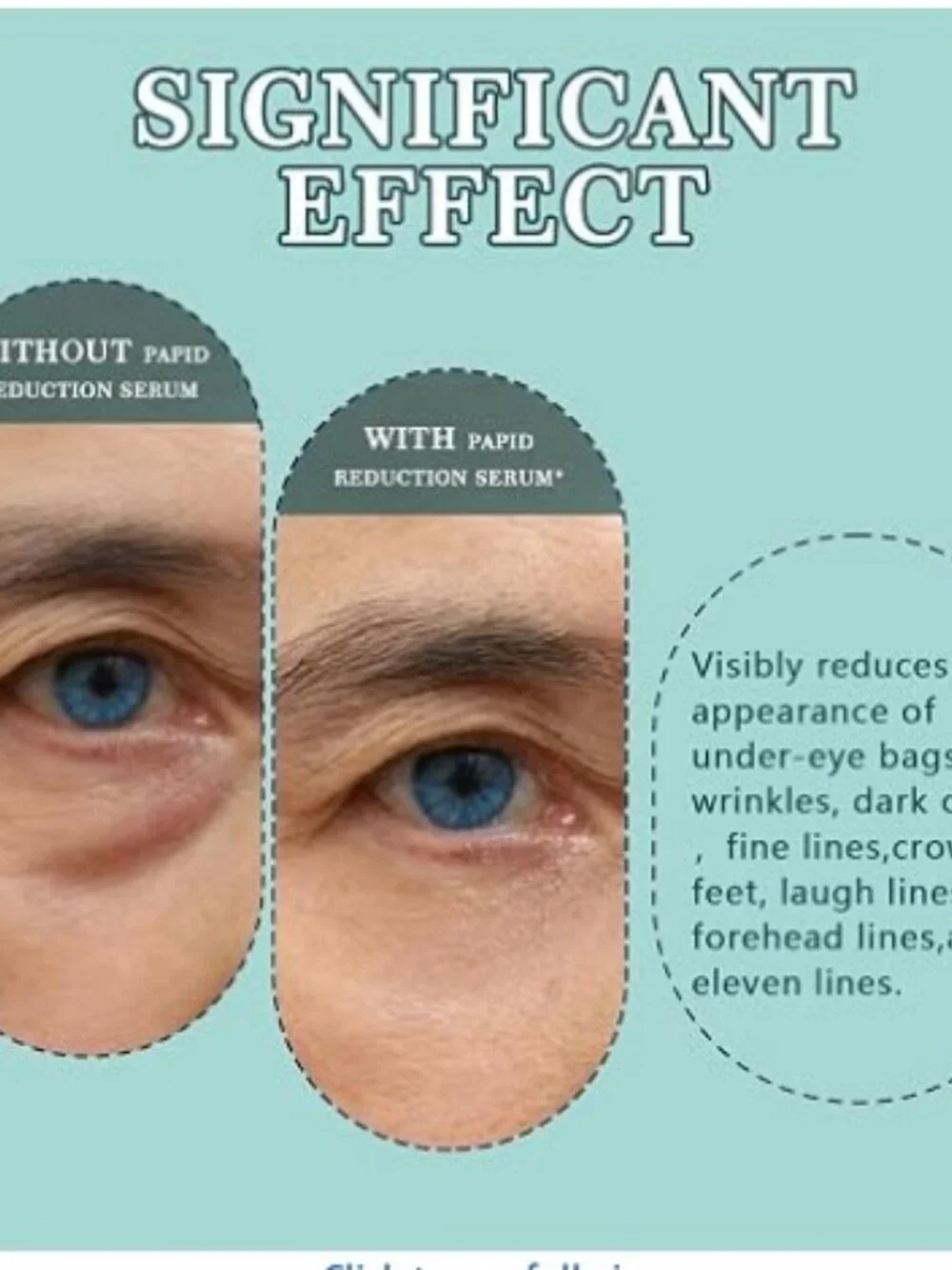 Perfection Instant Tightening Eye Serum Unisex
